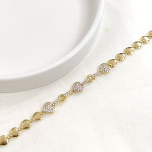 XUPING KALP BİLEKLİK GOLD 17+3 CM